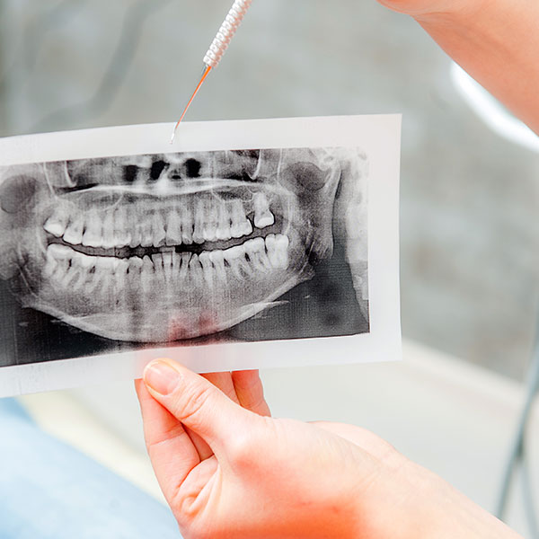 顯微根管治療<span>Micro Endodontics</span>